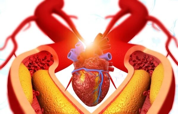 Illustration of a human heart with arteries, exploring what causes clogged arteries. A glowing effect highlights cross-sections of blood vessels.